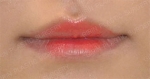 GIRIN Plastic Surgery. GIRIN aesthetic Clinic — Korea cost, reviews & before-after | MISOODA