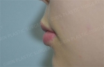 GIRIN Plastic Surgery. GIRIN aesthetic Clinic — Korea cost, reviews & before-after | MISOODA