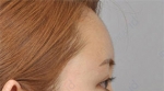 ID Plastic Surgery , Reviews, Images, Promotions — Korea cost, reviews & before-after | MISOODA
