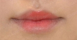 GIRIN Plastic Surgery. GIRIN aesthetic Clinic — Korea cost, reviews & before-after | MISOODA