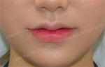 GIRIN Plastic Surgery. GIRIN aesthetic Clinic — Korea cost, reviews & before-after | MISOODA