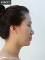 Banobagi Plastic Surgery,Reviews,Images, Promotions, MISOODA — Korea cost, reviews & before-after | MISOODA