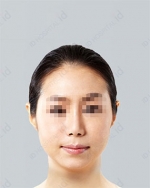 ID Plastic Surgery , Reviews, Images, Promotions — Korea cost, reviews & before-after | MISOODA