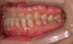 Newface Dental Hospital,Reviews,Images, Promotions — Korea cost, reviews & before-after | MISOODA