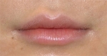 GIRIN Plastic Surgery. GIRIN aesthetic Clinic — Korea cost, reviews & before-after | MISOODA