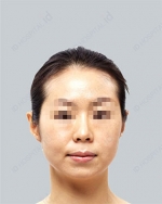 ID Plastic Surgery , Reviews, Images, Promotions — Korea cost, reviews & before-after | MISOODA