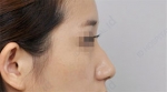 ID Plastic Surgery , Reviews, Images, Promotions — Korea cost, reviews & before-after | MISOODA