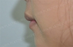 GIRIN Plastic Surgery. GIRIN aesthetic Clinic — Korea cost, reviews & before-after | MISOODA