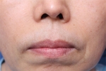 Deesse Plastic Surgery, Reviews,Images, Promotions — Korea cost, reviews & before-after | MISOODA