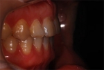 Newface Dental Hospital,Reviews,Images, Promotions — Korea cost, reviews & before-after | MISOODA