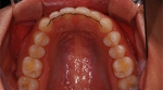 Newface Dental Hospital,Reviews,Images, Promotions — Korea cost, reviews & before-after | MISOODA
