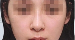 The Plastic Surgery, Reviews,Images, Promotions, — Korea cost, reviews & before-after | MISOODA