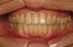 Newface Dental Hospital,Reviews,Images, Promotions — Korea cost, reviews & before-after | MISOODA