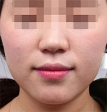 DA Plastic Surgery, Reviews, Images, Promotions — Korea cost, reviews & before-after | MISOODA