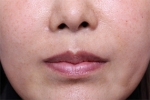 Deesse Plastic Surgery, Reviews,Images, Promotions — Korea cost, reviews & before-after | MISOODA