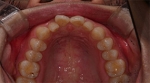 Newface Dental Hospital,Reviews,Images, Promotions — Korea cost, reviews & before-after | MISOODA