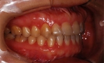Newface Dental Hospital,Reviews,Images, Promotions — Korea cost, reviews & before-after | MISOODA