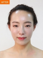 Banobagi Plastic Surgery,Reviews,Images, Promotions, MISOODA — Korea cost, reviews & before-after | MISOODA