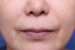 Deesse Plastic Surgery, Reviews,Images, Promotions — Korea cost, reviews & before-after | MISOODA