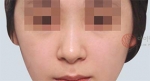 The Plastic Surgery, Reviews,Images, Promotions, — Korea cost, reviews & before-after | MISOODA