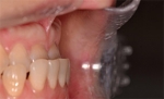 Newface Dental Hospital,Reviews,Images, Promotions — Korea cost, reviews & before-after | MISOODA