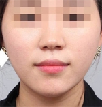 DA Plastic Surgery, Reviews, Images, Promotions — Korea cost, reviews & before-after | MISOODA