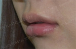 GIRIN Plastic Surgery. GIRIN aesthetic Clinic — Korea cost, reviews & before-after | MISOODA