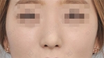 ID Plastic Surgery , Reviews, Images, Promotions — Korea cost, reviews & before-after | MISOODA