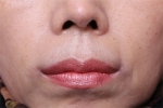 Deesse Plastic Surgery, Reviews,Images, Promotions — Korea cost, reviews & before-after | MISOODA