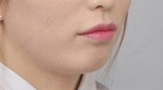 ID Plastic Surgery , Reviews, Images, Promotions — Korea cost, reviews & before-after | MISOODA