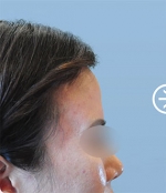 The Plastic Surgery, Reviews,Images, Promotions, — Korea cost, reviews & before-after | MISOODA