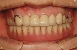 Newface Dental Hospital,Reviews,Images, Promotions — Korea cost, reviews & before-after | MISOODA
