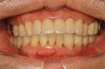 Newface Dental Hospital,Reviews,Images, Promotions — Korea cost, reviews & before-after | MISOODA