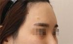 Rovl Avenue Liposuction,Reviews,Images, Promotions — Korea cost, reviews & before-after | MISOODA