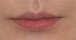 GIRIN Plastic Surgery. GIRIN aesthetic Clinic — Korea cost, reviews & before-after | MISOODA