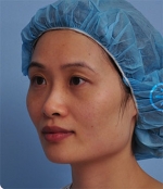 The Plastic Surgery, Reviews,Images, Promotions, — Korea cost, reviews & before-after | MISOODA