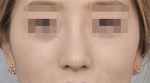 ID Plastic Surgery , Reviews, Images, Promotions — Korea cost, reviews & before-after | MISOODA