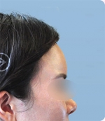 The Plastic Surgery, Reviews,Images, Promotions, — Korea cost, reviews & before-after | MISOODA