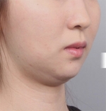DA Plastic Surgery, Reviews, Images, Promotions — Korea cost, reviews & before-after | MISOODA