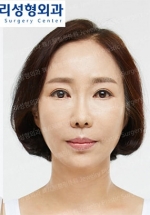 Jewelry Plastic Surgery,Reviews,Images, Promotions — Korea cost, reviews & before-after | MISOODA