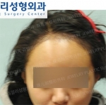 Jewelry Plastic Surgery,Reviews,Images, Promotions — Korea cost, reviews & before-after | MISOODA