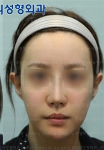Jewelry Plastic Surgery,Reviews,Images, Promotions — Korea cost, reviews & before-after | MISOODA