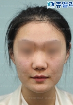 Jewelry Plastic Surgery,Reviews,Images, Promotions — Korea cost, reviews & before-after | MISOODA