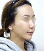 JAYJUN Plastic Surgery,Reviews,Images, Promotions — Korea cost, reviews & before-after | MISOODA