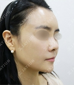 JAYJUN Plastic Surgery,Reviews,Images, Promotions — Korea cost, reviews & before-after | MISOODA