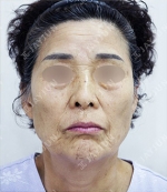 JAYJUN Plastic Surgery,Reviews,Images, Promotions — Korea cost, reviews & before-after | MISOODA