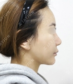 JAYJUN Plastic Surgery,Reviews,Images, Promotions — Korea cost, reviews & before-after | MISOODA
