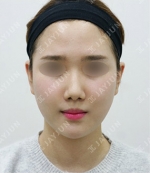 JAYJUN Plastic Surgery,Reviews,Images, Promotions — Korea cost, reviews & before-after | MISOODA