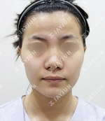 JAYJUN Plastic Surgery,Reviews,Images, Promotions — Korea cost, reviews & before-after | MISOODA