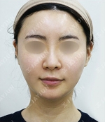 JAYJUN Plastic Surgery,Reviews,Images, Promotions — Korea cost, reviews & before-after | MISOODA
